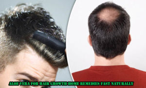 Aloe Vera For Hair Growth Home Remedies