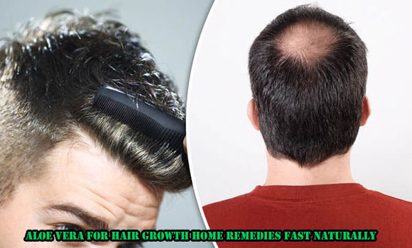 Aloe Vera For Hair Growth Home Remedies