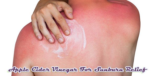 Apple Cider Vinegar For Sunburn Relief