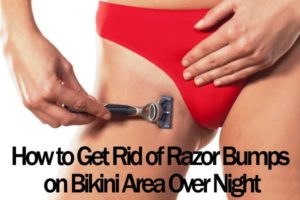 How to Get rid of Razor Bumps on Bikini Area Over Night