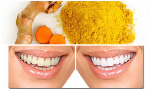 Turmeric-based paste for gums