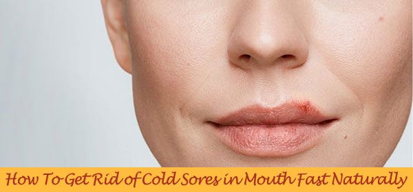 home remedies for cold sores in mouth